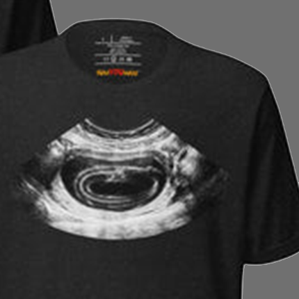 PARASITE tee with ultrasound graphic